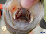 Sphincter?!
